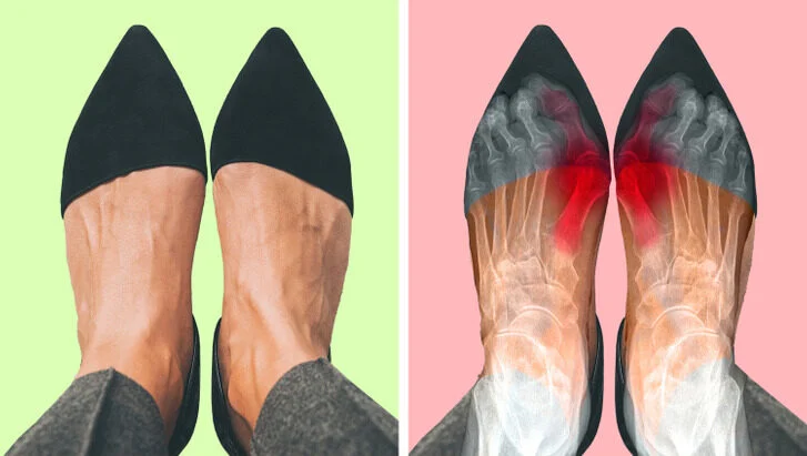 Porter des chaussures pointues