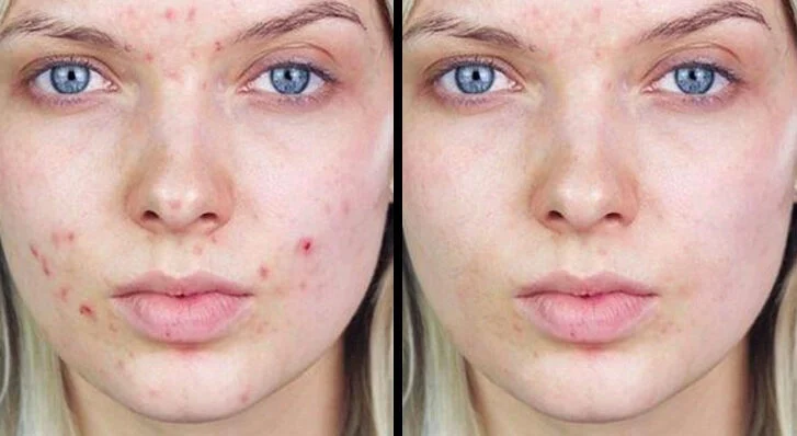 Retirer le maquillage avec les gels et les nettoyants moussants