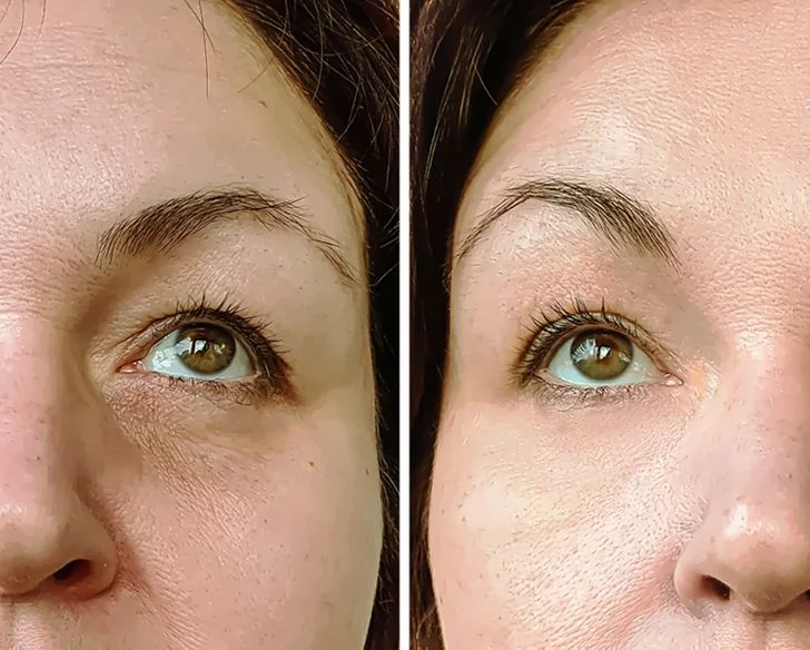 Elle transforme votre peau