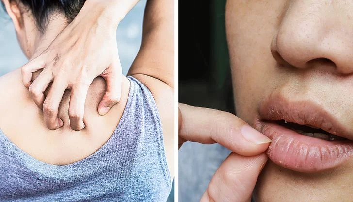 Elle réduit l'inflammation