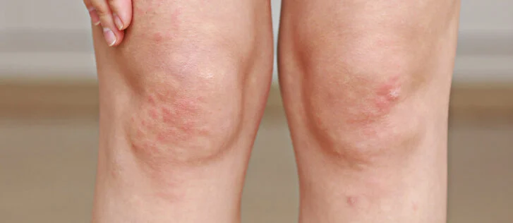 Jambes