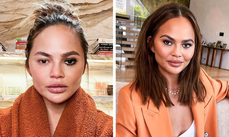 Chrissy Teigen