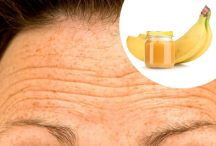 Les rides du visage