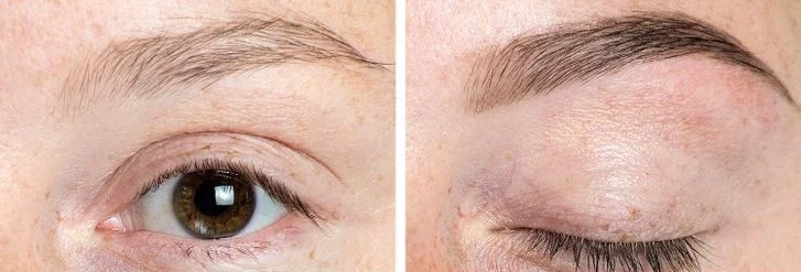 Les sourcils clairs