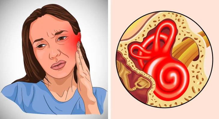 Il peut provoquer des infections