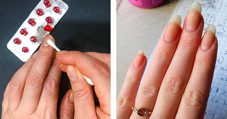 ongles La vitamine E