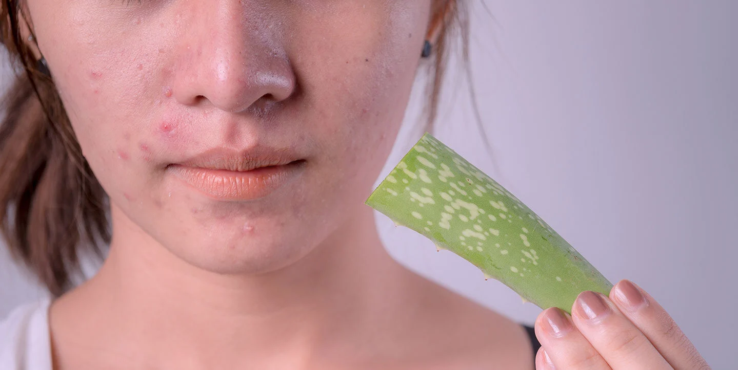 Aloe vera