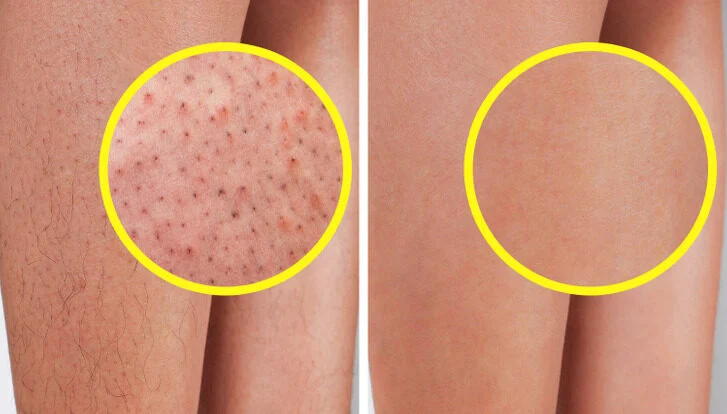 Mélangez vos lotions avec des acides alpha-hydroxylés