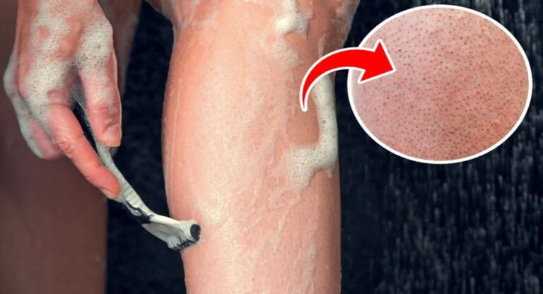 L’effet « jambes de fraise »