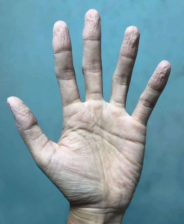 Les mains et les doigts ridés