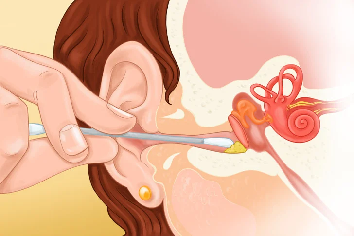 Peuvent causer des blessures