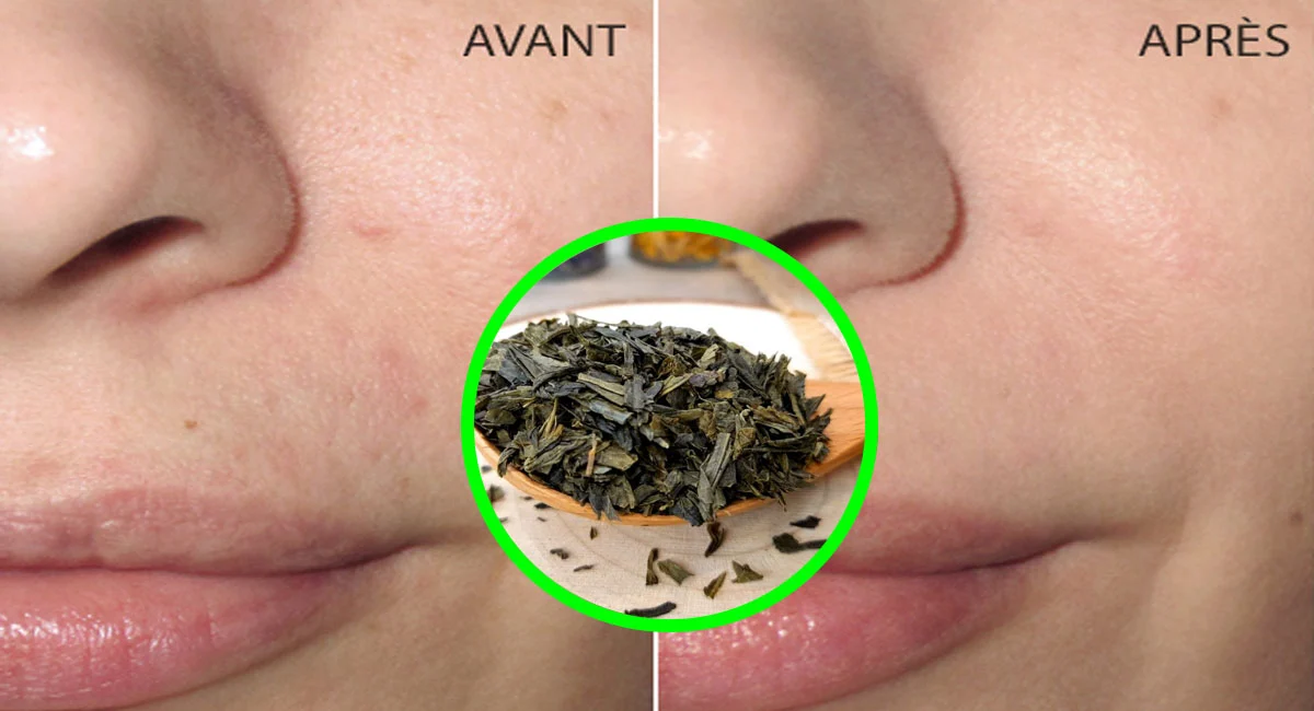 Thé Sencha : 7 avantages prouvés pour la peau