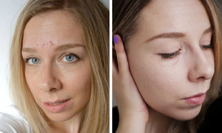 Réduire l'inflammation