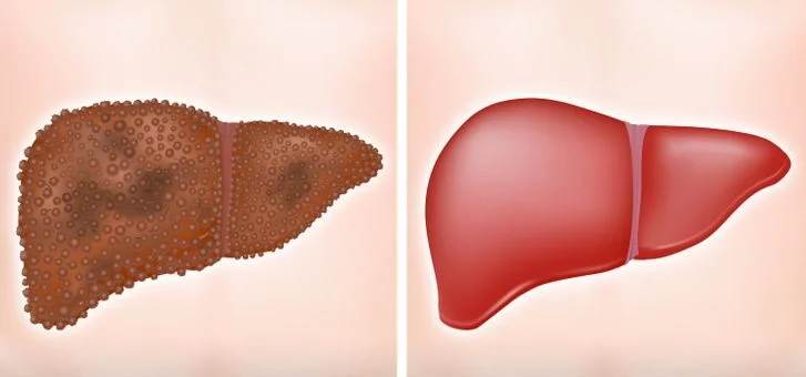Votre foie peut fonctionner plus efficacement