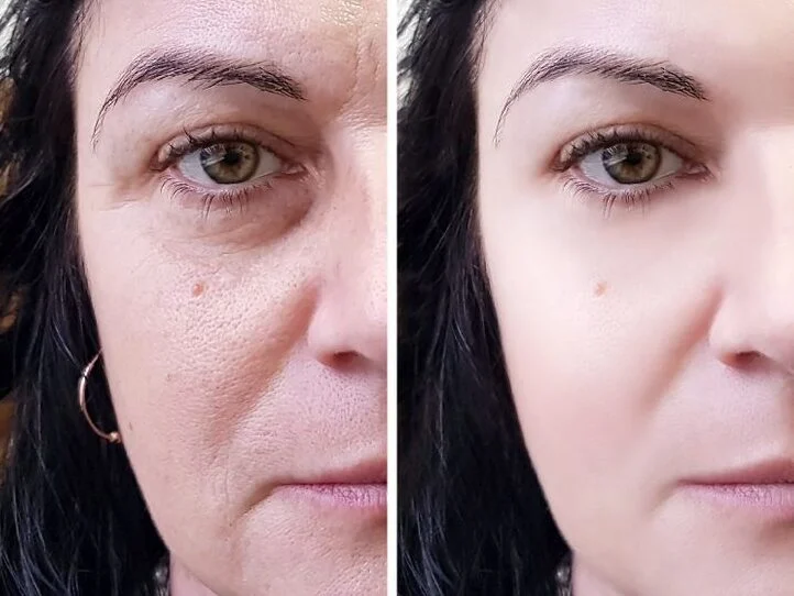Votre peau devient éclatante