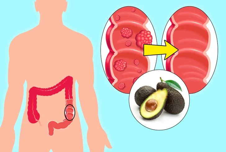 Vous pouvez obtenir une protection supplémentaire contre le cancer