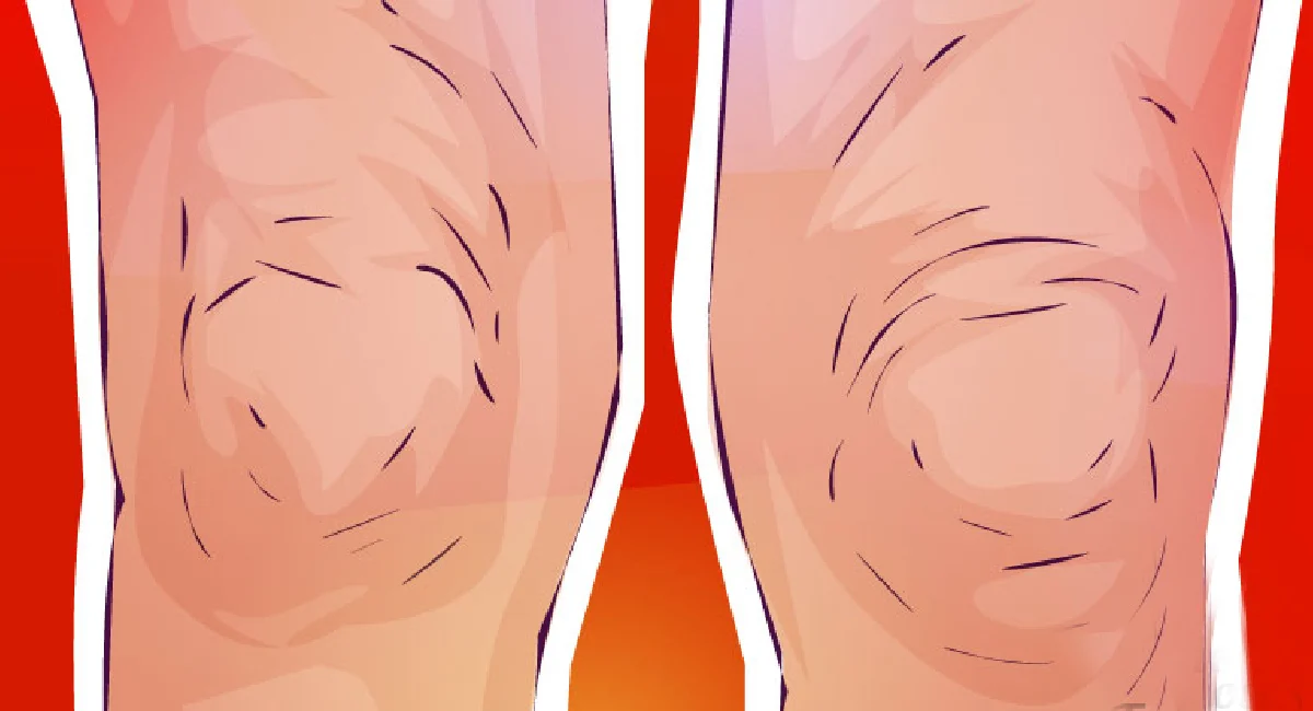6 conseils pour raffermir le relâchement de la peau des jambes