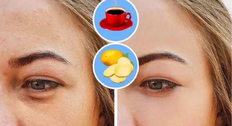 Les bienfaits du café pour la peau et les cheveux