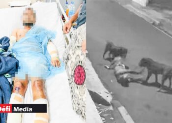 « Ils m&rsquo;ont mangé » : attaqué par deux molosses en plein footing, un joggeur lutte désespérément pour survivre