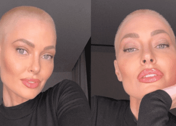 Caroline Receveur ménopausée à 36 ans à cause de sa radiothérapie contre le cancer du sein