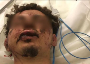 Reims : Lycéen enlevé, séquestré et frappé, voici ce que l’on sait de l’enquête