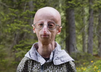 Sammy Basso : atteint d’une maladie à l’espérance de vie de 13 ans, il est finalement mort à 28 ans