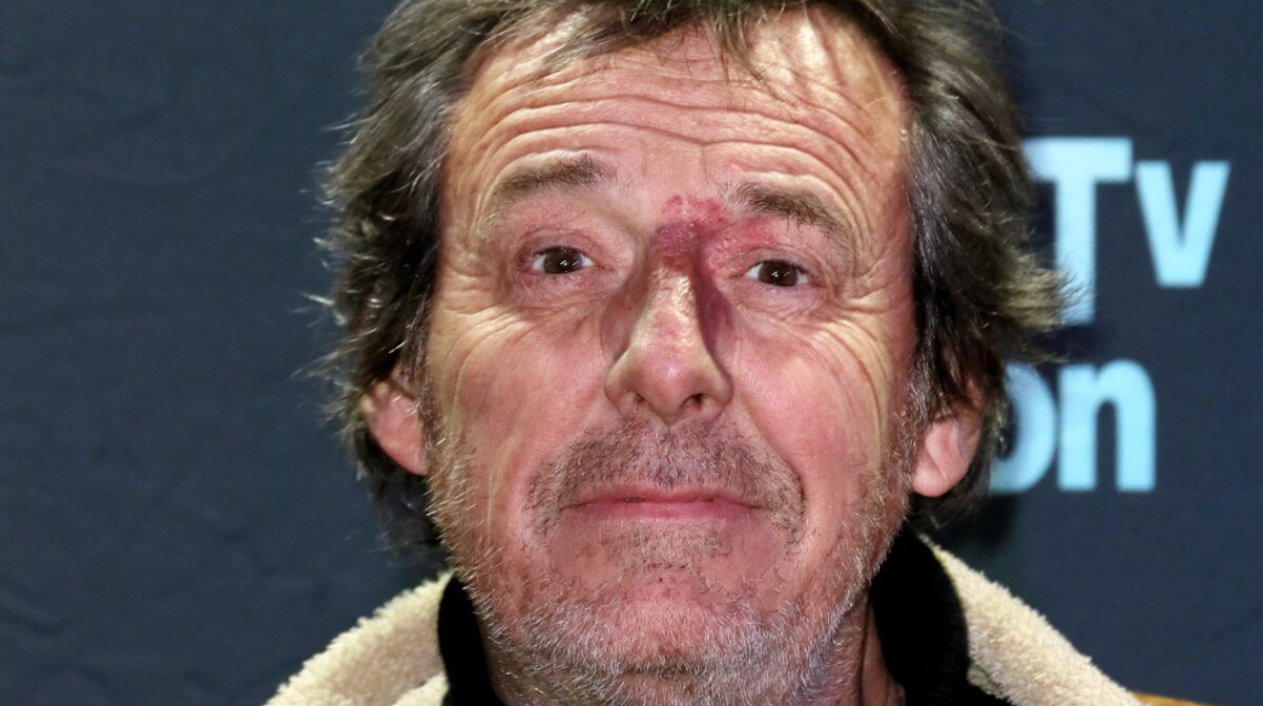 Capture decran 2024 12 09 205435 Jean-Luc Reichmann