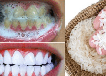 L’astuce pour blanchir les dents avec du riz 4 L’astuce pour blanchir les dents avec du riz L’astuce pour blanchir les dents avec du riz