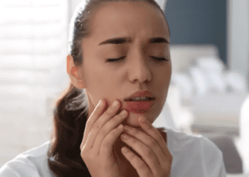 Bouton de fièvre : 12 remèdes incroyables de grand-mère à tester !