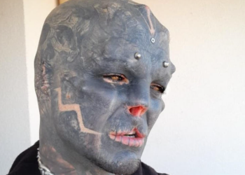 Black Alien repousse les limites : sa nouvelle opération radicale !