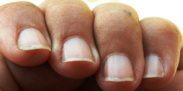 Ongles striés : ce qu’ils révèlent sur votre santé