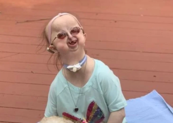 Lorsque bébé Michelle est née, la pièce était silencieuse. 22 ans plus tard, elle est INCROYABLE !