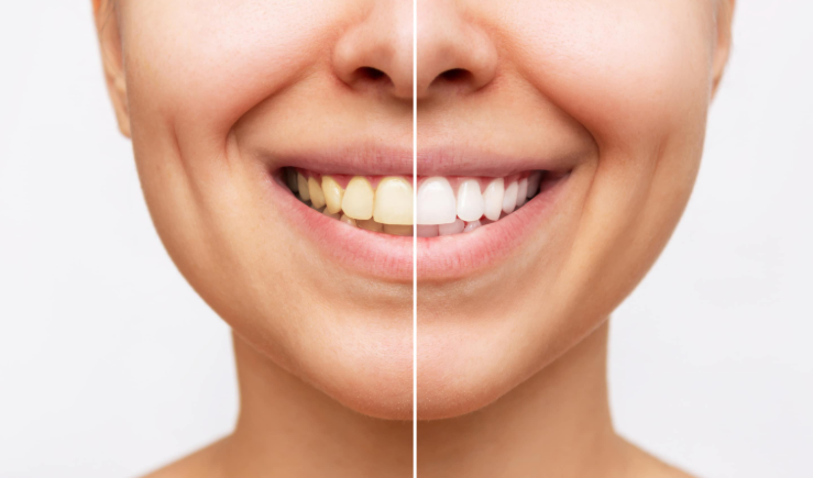 Capture decran 2025 05 09 145807 dents