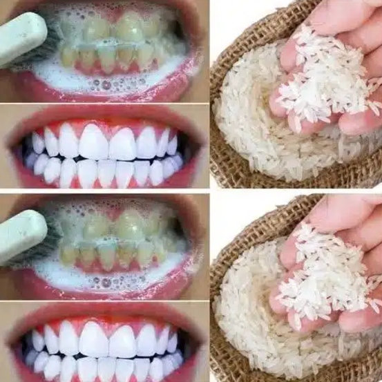 Capture decran 2025 05 09 145831 dents