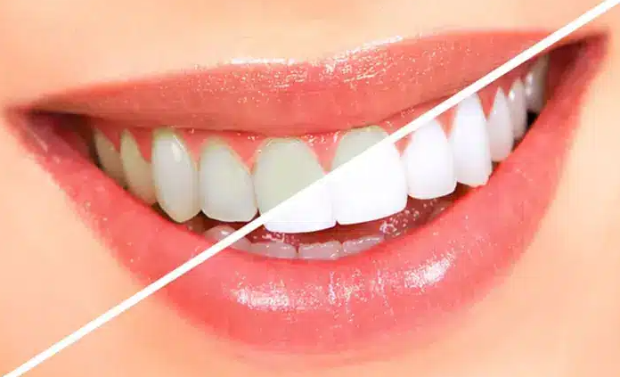 Capture decran 2025 05 09 145853 dents