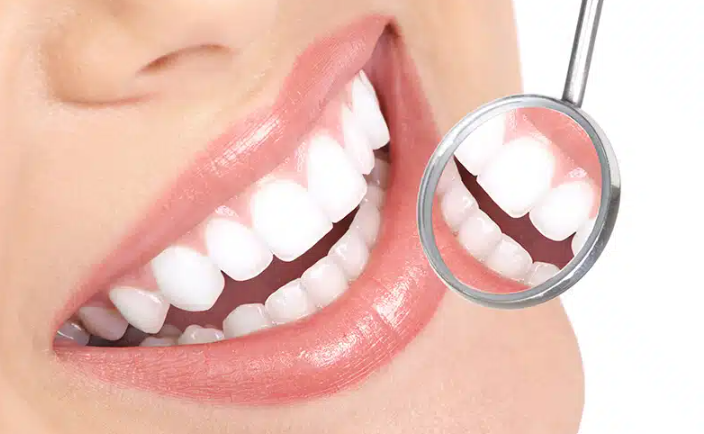 Capture decran 2025 05 09 145904 dents