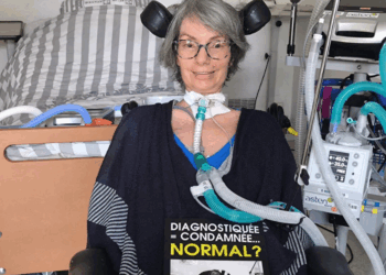 « C&rsquo;est un signal d&rsquo;alerte » selon un neurologue : ces personnes ont plus de risques d&rsquo;avoir la maladie de Charcot