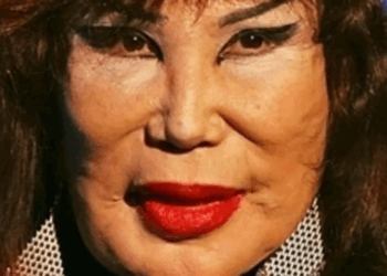 Star de 100 films, son apparence ruinée par une erreur tragique ! 9 Star de 100 films, son apparence ruinée par une erreur tragique ! Star de 100 films, son apparence ruinée par une erreur tragique !