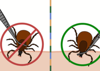 Comment se débarrasser d’une tique ? 3 astuces à connaître. 9 Comment se débarrasser d’une tique ? 3 astuces à connaître. Comment se débarrasser d’une tique ? 3 astuces à connaître.