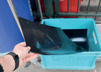 Il est fortement déconseillé de jeter vos radiographies à la poubelle, voici pourquoi