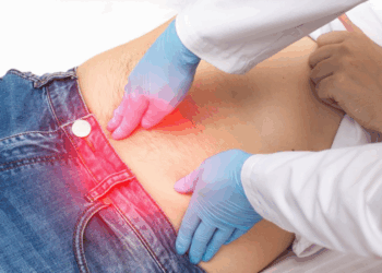 Hernie ombilicale : pourquoi il faut tout de suite agir si vous voyez ça sur votre nombril