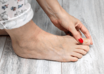 Adieu mycose des ongles : découvrez le secret naturel pour l&rsquo;éliminer rapidement !