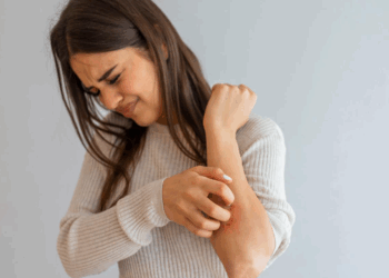 Le psoriasis, cette maladie de peau très répandue est incurable