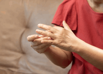 Transmission, symptômes, séquelles: faut-il avoir peur du chikungunya?