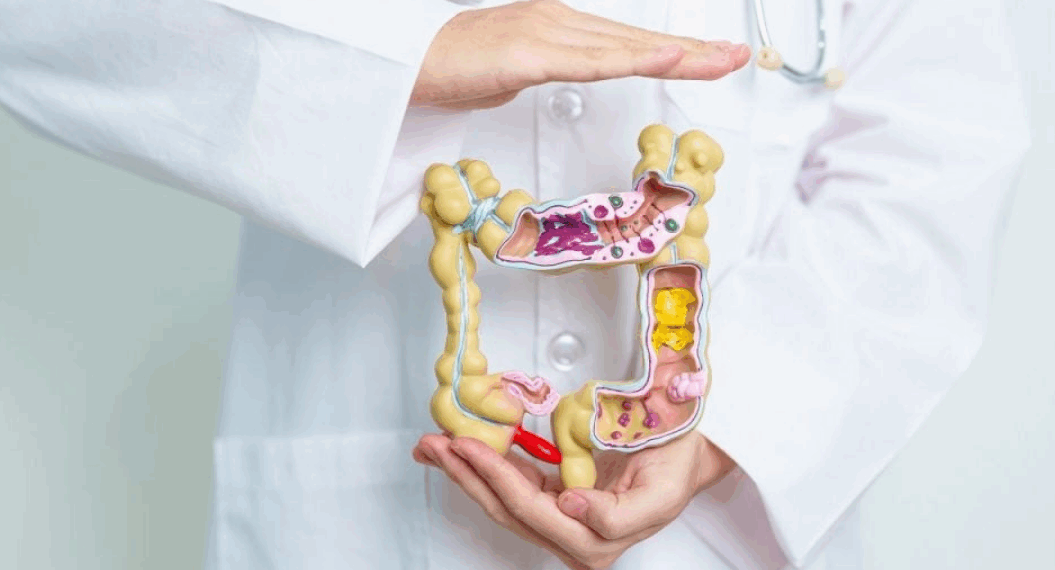 "Je croyais que j’allais exploser" : elle découvre un cancer du côlon en phase terminale après des mois d’erreurs médicales 8 "Je croyais que j’allais exploser" : elle découvre un cancer du côlon en phase terminale après des mois d’erreurs médicales « Je croyais que j’allais exploser » : elle découvre un cancer du côlon en phase terminale après des mois d’erreurs médicales