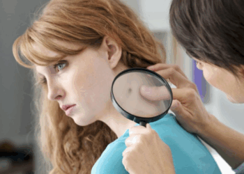 Une femme de 34 ans a développé un cancer de la peau agressif à cause d&rsquo;un virus très commun, une première médicale