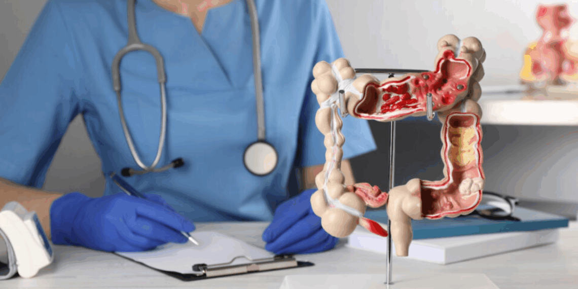 Cancer du côlon : cet oncologue recommande de bannir ces 2 produits courants de la salle de bains 8 Cancer du côlon : cet oncologue recommande de bannir ces 2 produits courants de la salle de bains Cancer du côlon : cet oncologue recommande de bannir ces 2 produits courants de la salle de bains