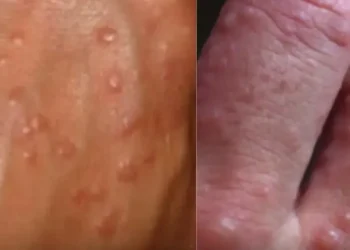 a0d9604d 28a4 417f 896f a1f02b9f65e3