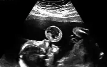 bc3b4b14 b212 4f4d be42 71291f41126c