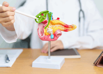 Le cancer du pancréas progresse : quels sont les facteurs de risque et comment l’éviter ?